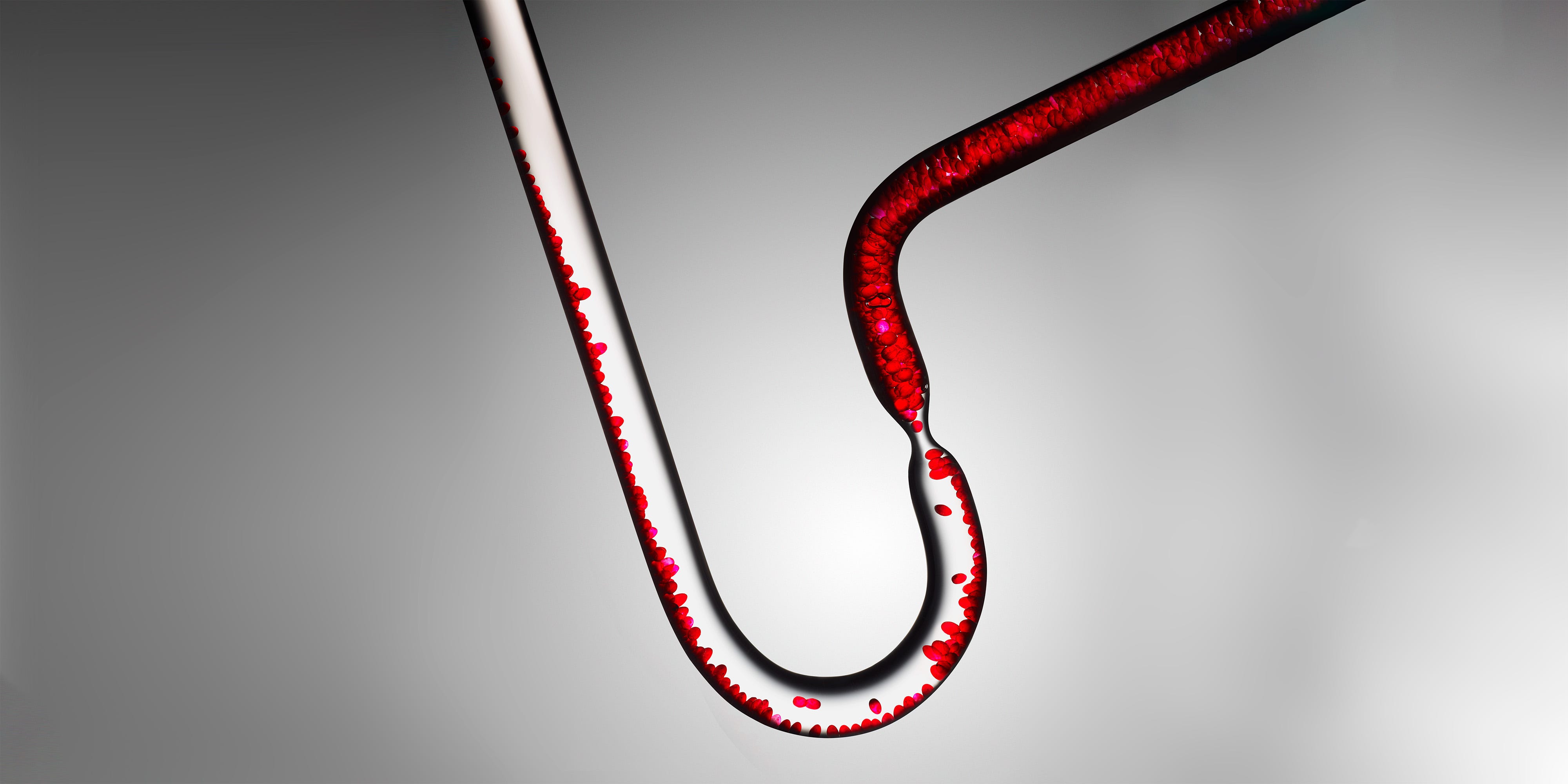 The New Rules of Cholesterol Lowering and Statin Use